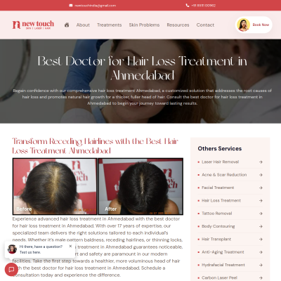 Screenshot of https://newtouch.in/hair-loss-treatment-ahmedabad